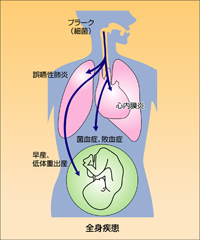 全身疾患